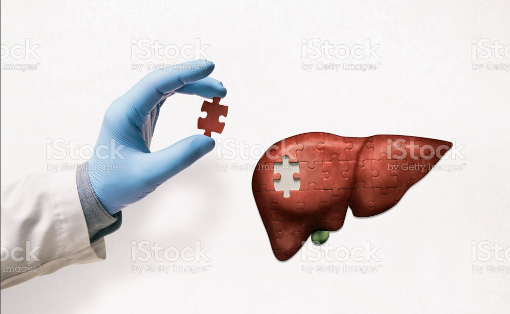 organ transplantaion
